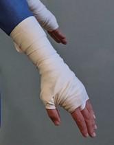 arm_wrap_example.jpg